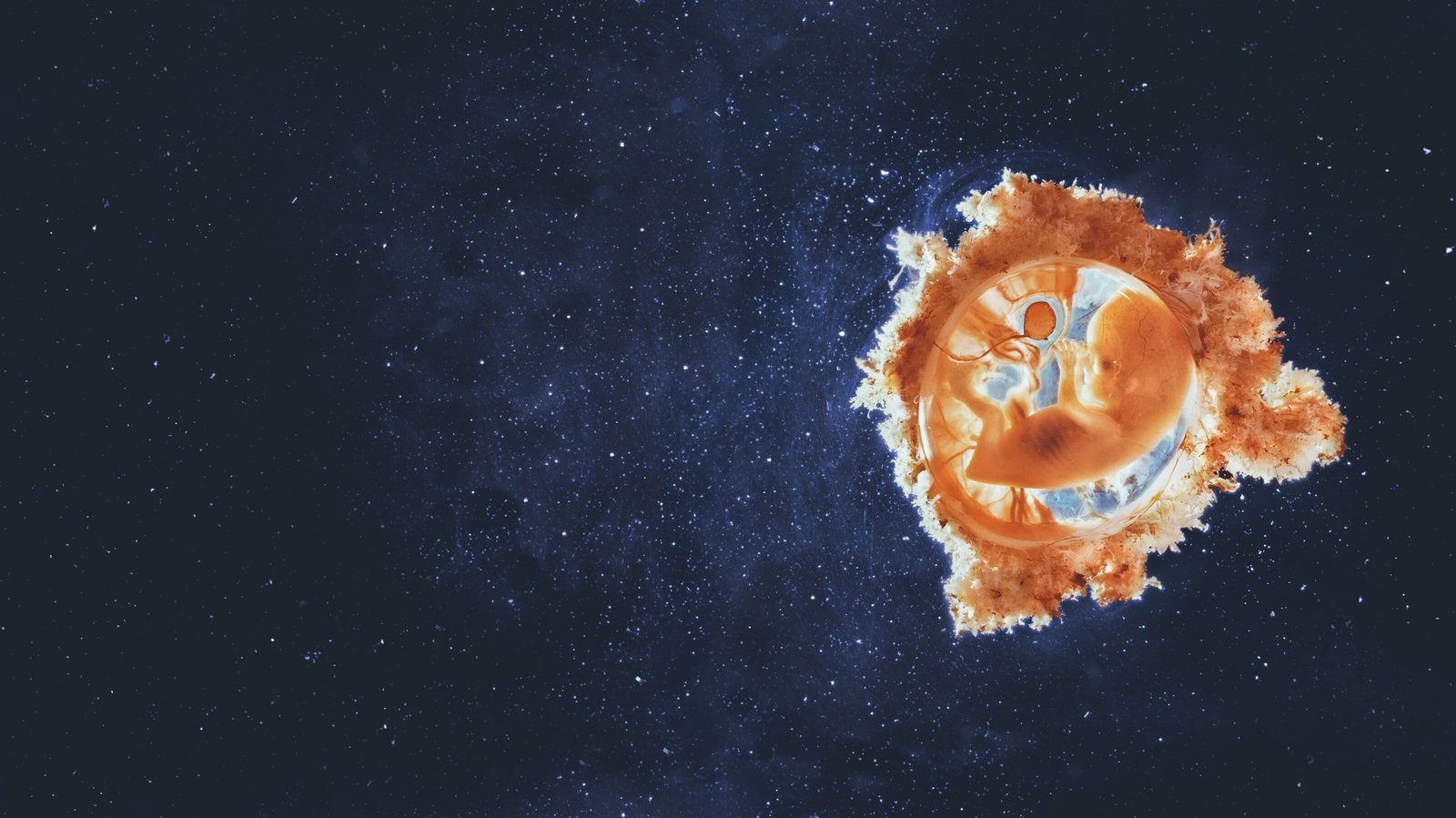 Foetus Aude Tessier.png